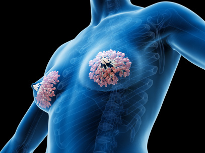 Adobestock 548001428