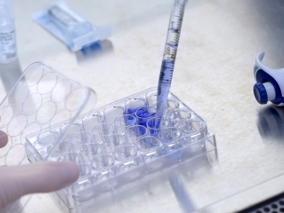 TIL therapie_innovatie