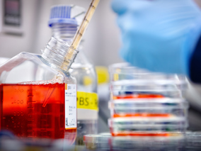 NKI laboratorium onderzoek