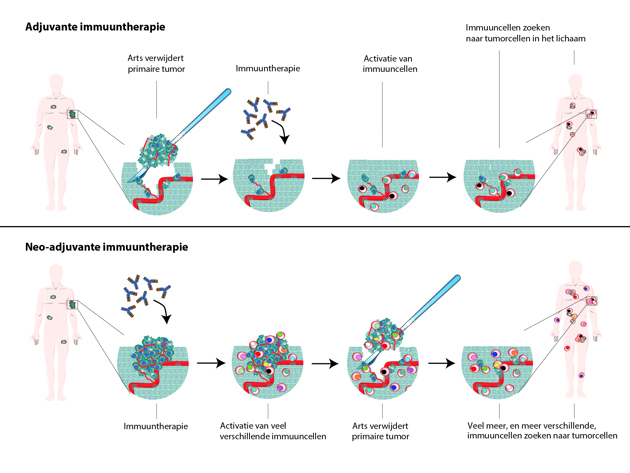 Illustratie Neo Adjuvante Immuuntherapie C Jacqueline Staring