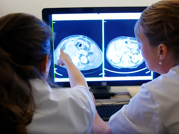 Darmkanker - video still