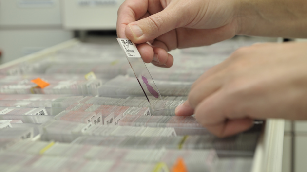 Behandeling op maat NKI onderzoek