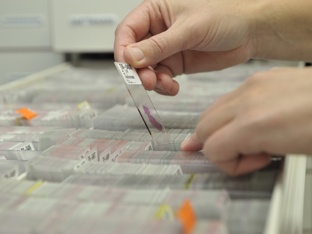 Behandeling op maat NKI onderzoek