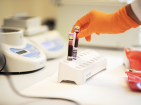 Bloedbuizen Worden In Rek Rek Gestopt