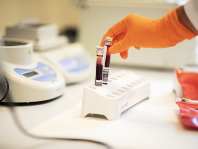 Bloedbuizen Worden In Rek Rek Gestopt