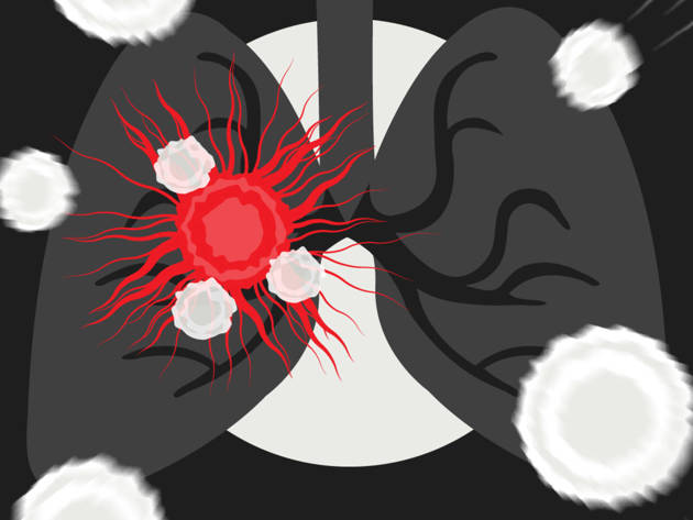 Afbeelding NOS Wanneer Gaan We Niet Meer Dood Aan Kanker