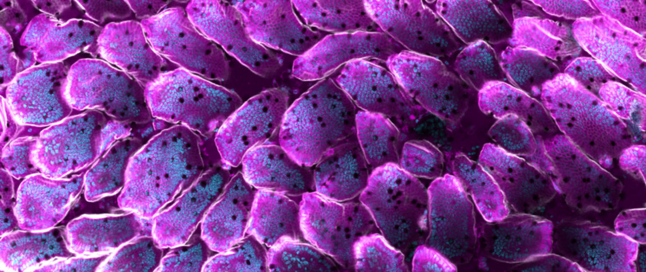 Afbeelding Lotte Bruens Darmvilli Jan '20 Post