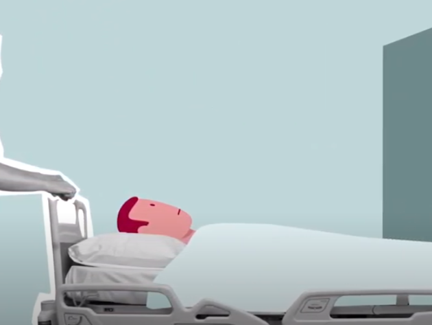 Operatie Animatie Stil