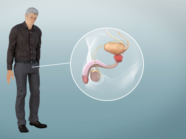 videostill animatie hormoontherapie porstaatkanker NVU