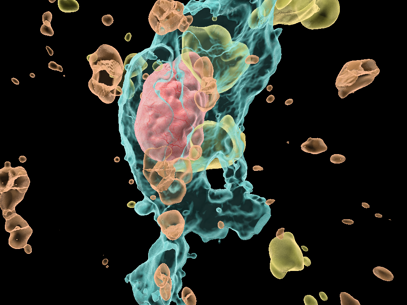 Figuur B - 3D model vet-geladen macrofaag in glioblastoom die myeline opneemt