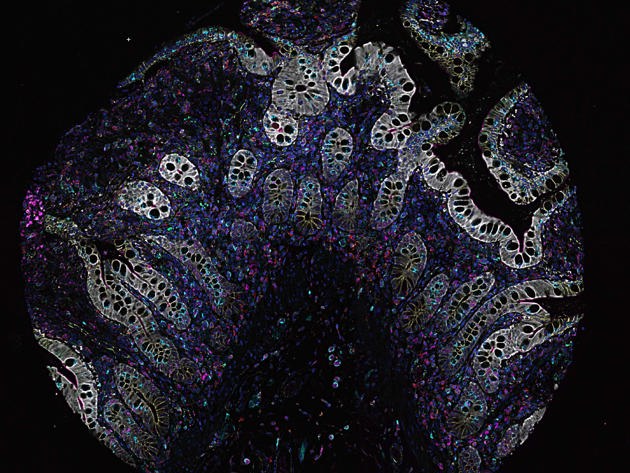 Nr 3 Irisseignette Final