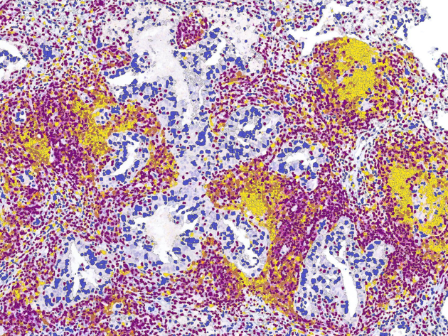 Picture For Website NKI Banner Thommen Group