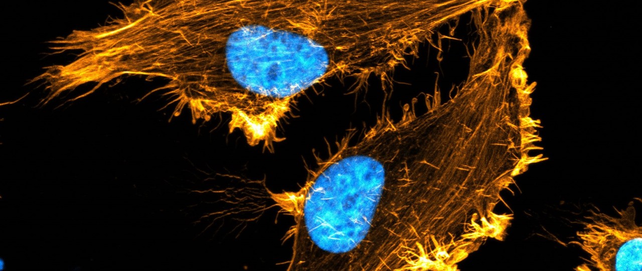 Afbeelding Actine 2 Peter Haahr Geel Actine Celskelet Blauw Celkern