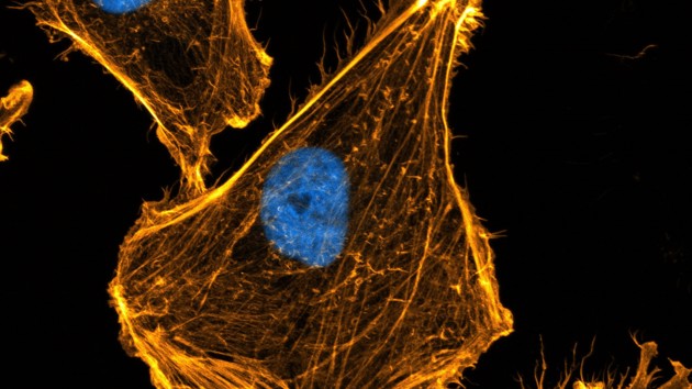 Afbeelding Actine Copyright Peter Haahr NKI Geel Actine Celskelet Blauw Celkern