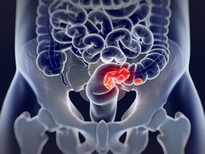 Webinar mdl afbeelding