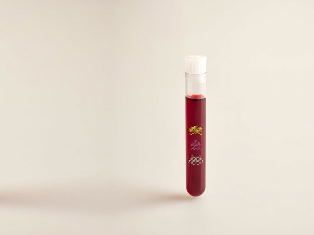 AVL Bloedonderzoek Opener300dpirgb KLEIN AANZET