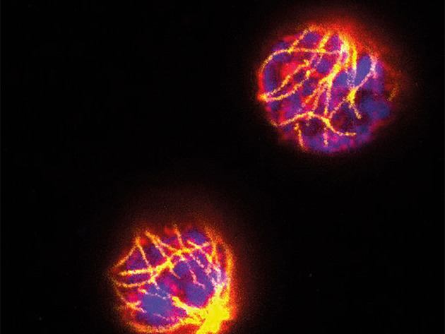 Taxaan Gestimuleerde T Cellen