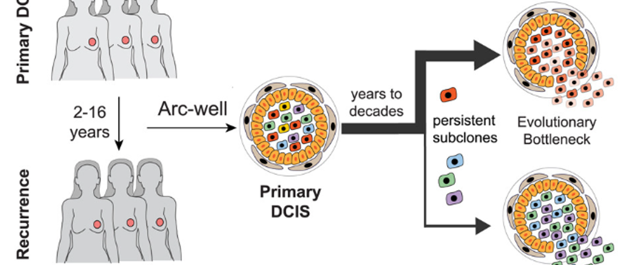 DCIS Figure 2 Lips