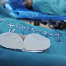 Bostkanker Implantaten Adobe Stock