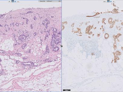 Presentation Biomarkers 2