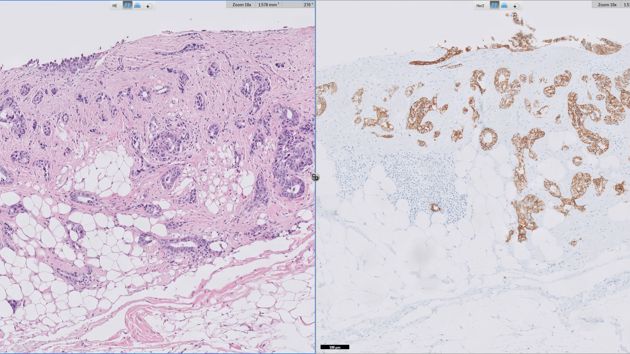 Presentation Biomarkers 2