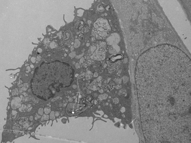 Figuur C - interactie vet-geladen macrofaag en glioblastoom