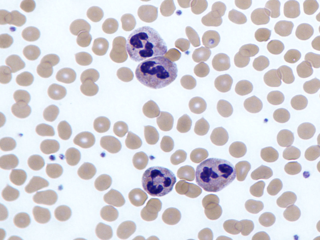 Foto Neutrophils Kdv