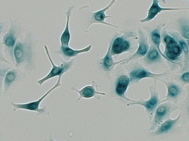 Foto Slapende Cellen Behandeling Op Maat 2024