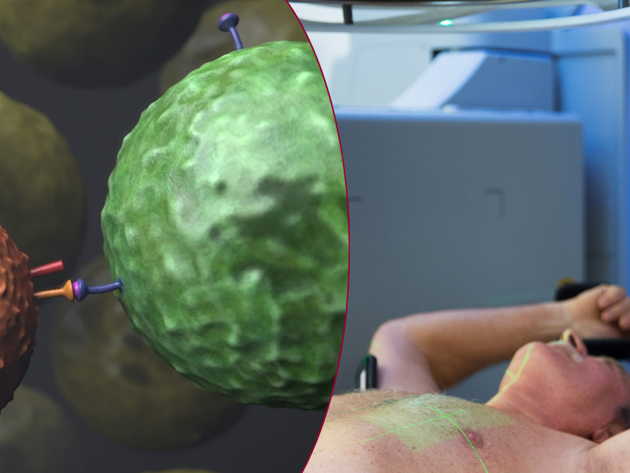 Immuun En Radiotherapie AVL