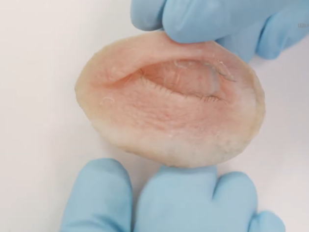 Grondige Schoonmaak Prothese