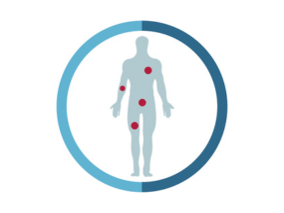 NET, Sarcomen, Huidkanker