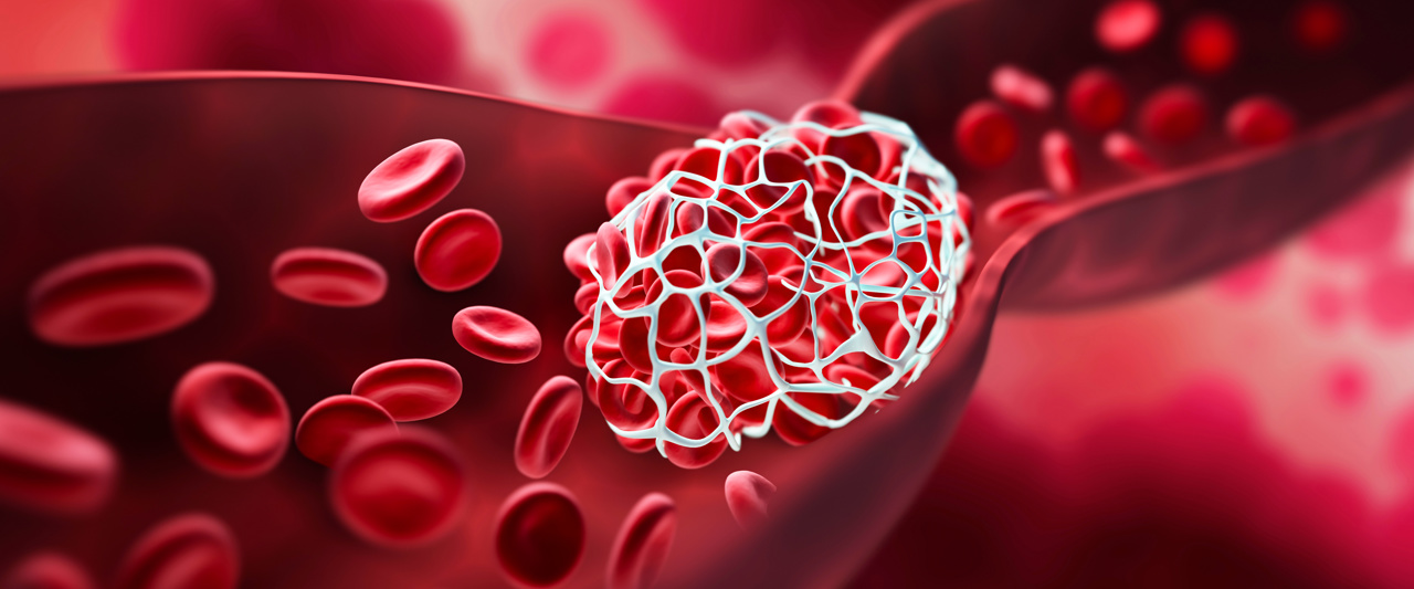 Adobestock 446073656