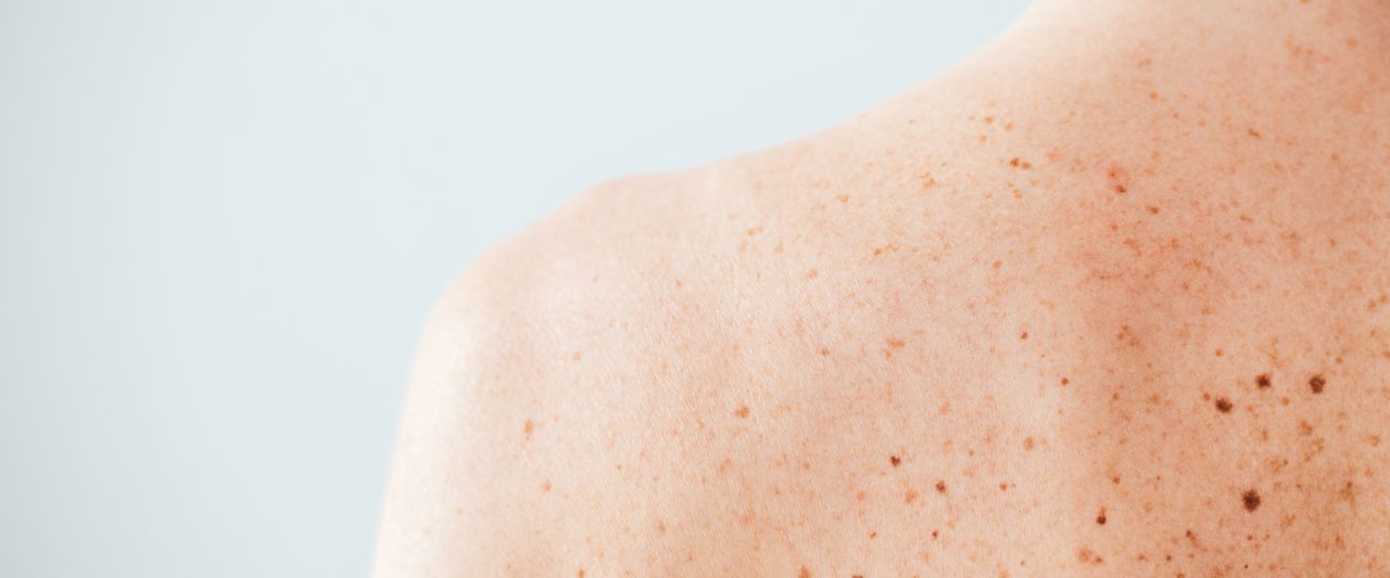 Adobestock 264437586